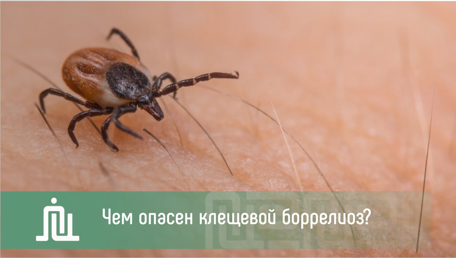 Чем опасен клещевой боррелиоз?